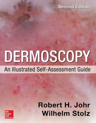 Dermoscopy: An Illustrated Self-Assessment Guide, 2/E by Johr, Robert
