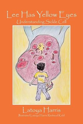 Lee Has Yellow Eyes: Understanding Sickle Cell by Harris, Latoya
