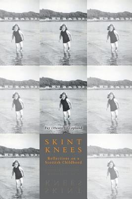 Skint Knees: Reflections on a Scottish Childhood by Copland, Fay (Hawson)