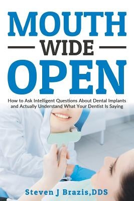 Mouth Wide Open: How To Ask Intelligent Questions About Dental Implants and Actually Understand What Your Dentist Is Saying by Brazis Dds, Steven J.