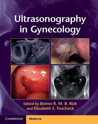 Ultrasonography in Gynecology by Rizk, Botros R. M. B.