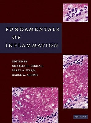 Fundamentals of Inflammation by Serhan, Charles N.