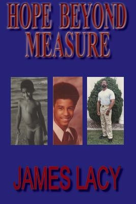 Hope Beyond Measure by Lacy, James
