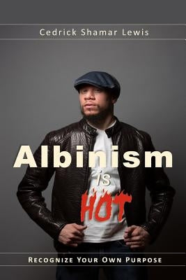 Albinism is Hot! by Lewis, Cedrick Shamar