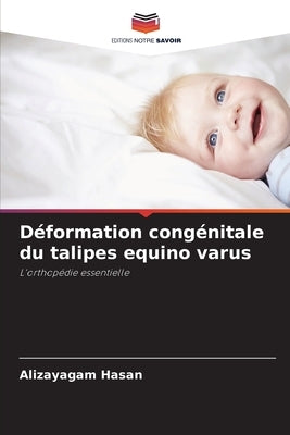 Déformation congénitale du talipes equino varus by Hasan, Alizayagam