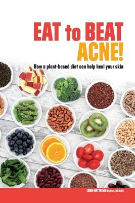 Eat to Beat Acne!: How a plant-based diet can help heal your skin. by Matthews, Leigh