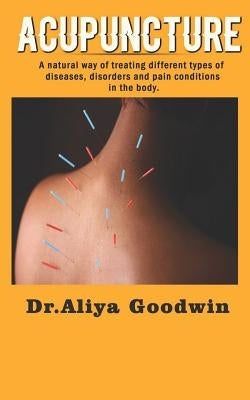 Acupuncture: A Natural Way of Treating Different Types of Diseases, Disorders and Pain Conditions in the Body by Goodwin, Aliya