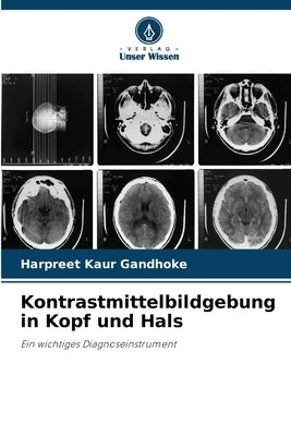 Kontrastmittelbildgebung in Kopf und Hals by Gandhoke, Harpreet Kaur