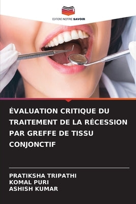 Évaluation Critique Du Traitement de la Récession Par Greffe de Tissu Conjonctif by Tripathi, Pratiksha