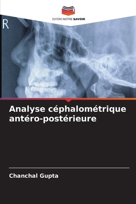 Analyse céphalométrique antéro-postérieure by Gupta, Chanchal