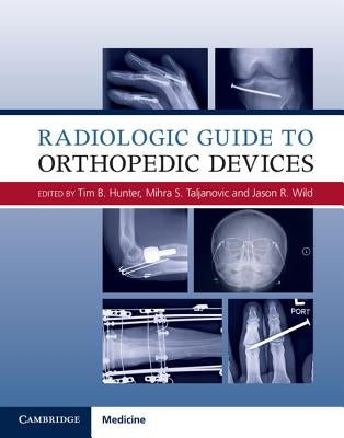 Radiologic Guide to Orthopedic Devices by Hunter, Tim B.