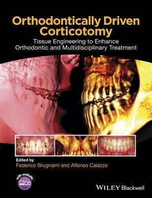 Orthodontically Driven Corticotomy: Tissue Engineering to Enhance Orthodontic and Multidisciplinary Treatment by Brugnami, Federico