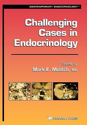 Challenging Cases in Endocrinology by Molitch, Mark E.