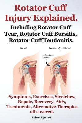 Rotator Cuff Injury Explained. Including Rotator Cuff Tear, Rotator Cuff Bursitis, Rotator Cuff Tendonitis. Symptoms, Exercises, Stretches, Repair, Re by Rymore, Robert