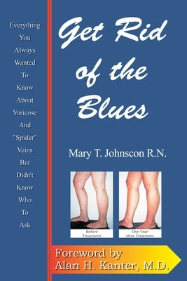 Get Rid of the Blues: Everything You Always Wanted to Know about Varicose and "Spider" Veins But Didn't Know Who to Ask by Johnson, Mary T.