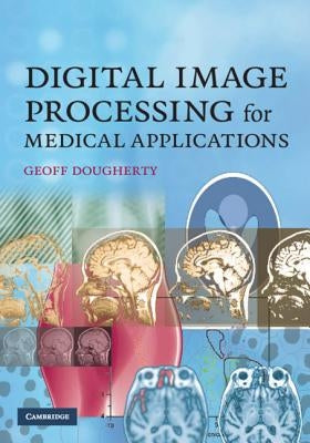 Digital Image Processing for Medical Applications by Dougherty, Geoff