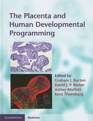 The Placenta and Human Developmental Programming by Burton, Graham J.