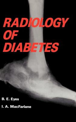 Radiology of Diabetes by Eyes, B.