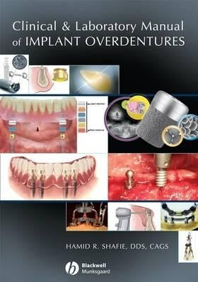 Clinical and Laboratory Manual of Implant Overdentures by Shafie, Hamid R.