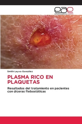 Plasma Rico En Plaquetas by Leyva Gonz&#225;lez, Smith