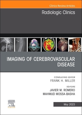 Imaging of Cerebrovascular Disease, an Issue of Radiologic Clinics of North America: Volume 61-3 by Romero, Javier M.