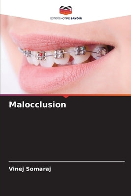 Malocclusion by Somaraj, Vinej