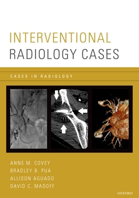 Interventional Radiology Cases by Covey, Anne M.