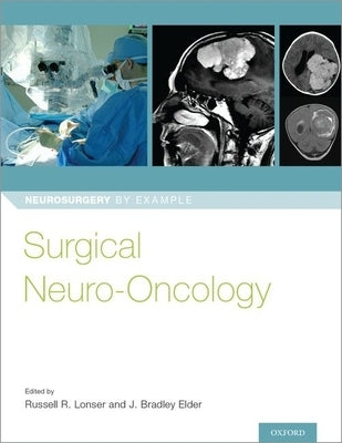 Surgical Neuro-Oncology by Lonser, Russell R.