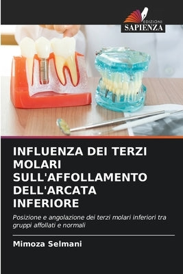 Influenza Dei Terzi Molari Sull'affollamento Dell'arcata Inferiore by Selmani, Mimoza