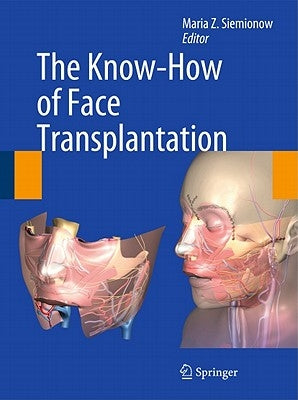 The Know-How of Face Transplantation by Siemionow, Maria Z.