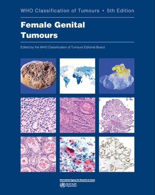 Female Genital Tumours: Who Classification of Tumours by Who Classification of Tumours Editorial