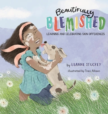 Beautifully Blemished: Learning and Celebrating Skin Differences by Stuckey, Leanne