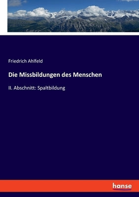 Die Missbildungen des Menschen: II. Abschnitt: Spaltbildung by Ahlfeld, Friedrich