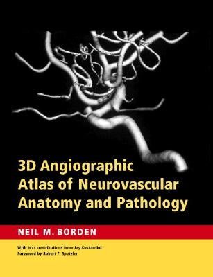 3D Angiographic Atlas of Neurovascular Anatomy and Pathology by Borden, Neil M.