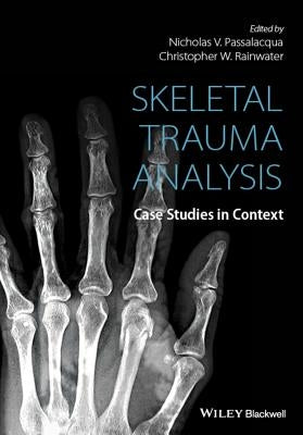Skeletal Trauma Analysis by Rainwater, Christopher W.