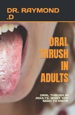 Oral Thrush in Adults: Oral Thrush in Adults: What You Need to Know by D, Raymond