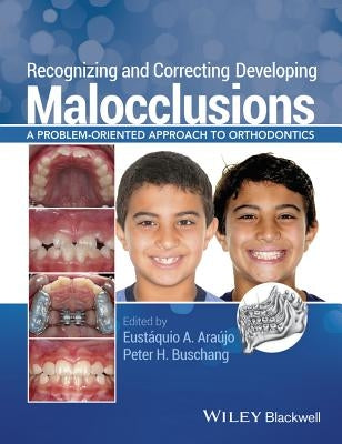 Recognizing and Correcting Dev by Araújo
