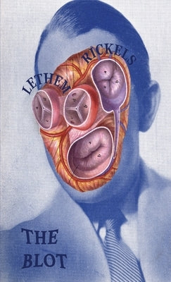 The Blot by Lethem, Jonathan