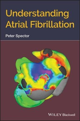 Understanding Atrial Fibrillation by Spector, Peter