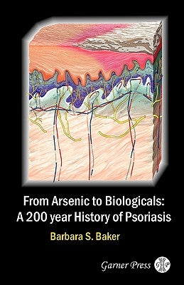 From Arsenic to Biologicals: A 200 Year History of Psoriasis by Baker, Barbara S.
