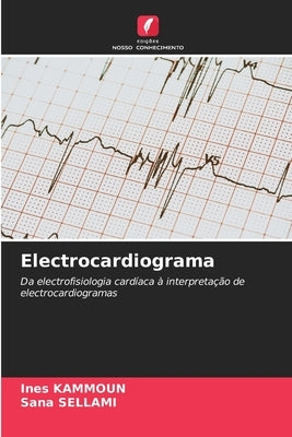 Electrocardiograma by Kammoun, Ines