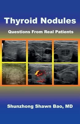 Thyroid Nodules: Questions From Real Patients by Winter, Barbara