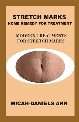 Stretch Marks Home Remedy for Treatment: Modern Treatment for Stretch Marks by Ann, Micah-Daniels