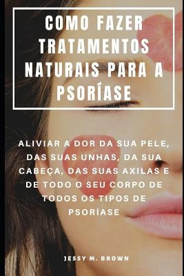 Como Fazer Tratamentos Naturais Para a Psoríase: Aliviar a Dor Da Sua Pele, Das Suas Unhas, Da Sua Cabeça, Das Suas Axilas E de Todo O Seu Corpo de To by Almeida, Rita