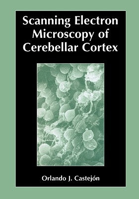 Scanning Electron Microscopy of Cerebellar Cortex by Castejon, Orlando