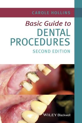 Basic Guide to Dental Procedures 2e by Hollins, Carole