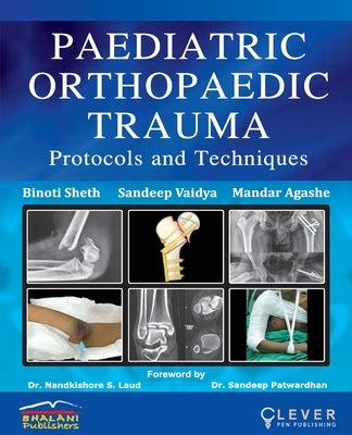 "PAEDIATRIC ORTHOPAEDIC TRAUMA Protocols and Techniques" by Sheth, Binoti