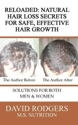 Reloaded: Natural Hair Loss Secrets for Safe, Effective Hair Growth by Rodgers M. S., David