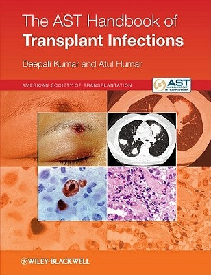The Ast Handbook of Transplant Infections by Kumar, Deepali