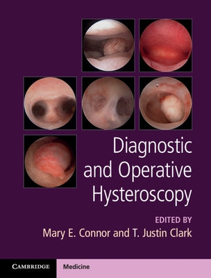 Diagnostic and Operative Hysteroscopy by Connor, Mary E.